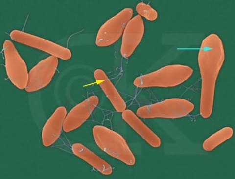 Возбудитель ботулизма Clostridium botulinum Возбудитель ботулизма Clostridium botulinum